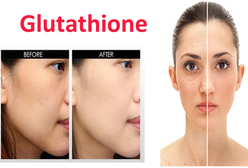 Glutathione