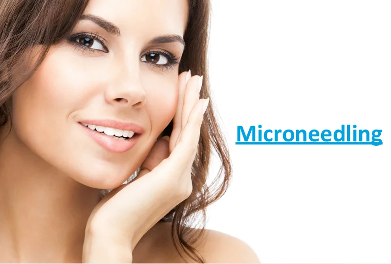 RF Microneedling