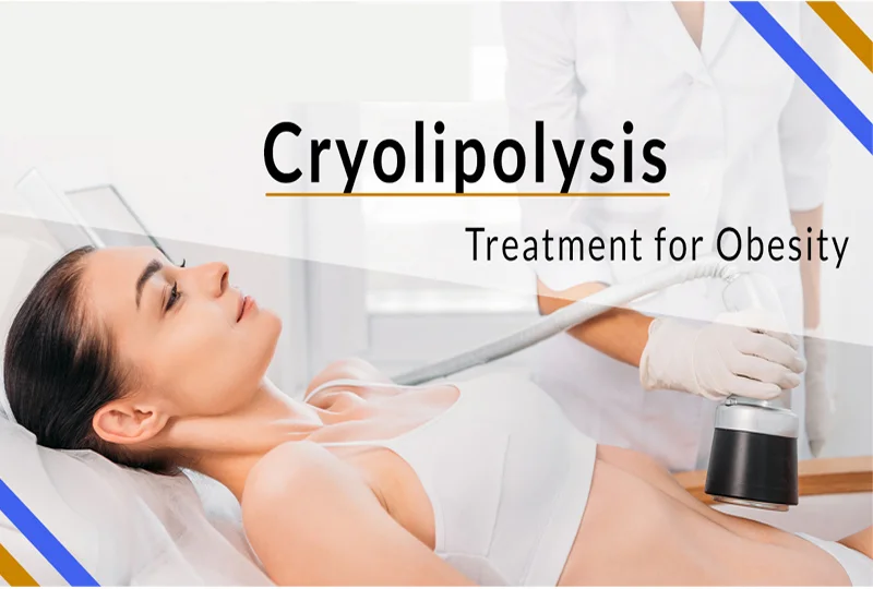 Cryolipolysis