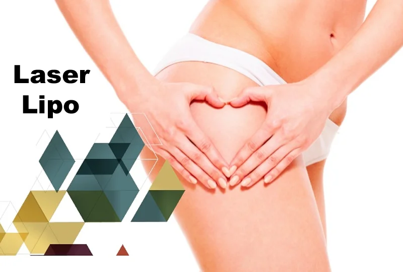 Laser Lipo