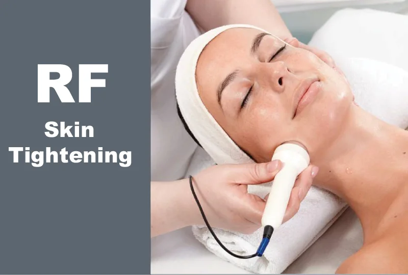 RF Tightening
