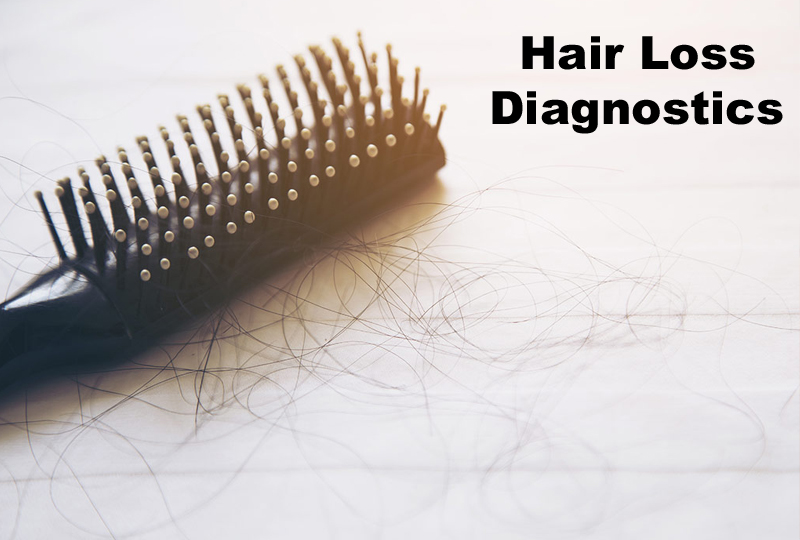 Hair Loss Diagnostics
