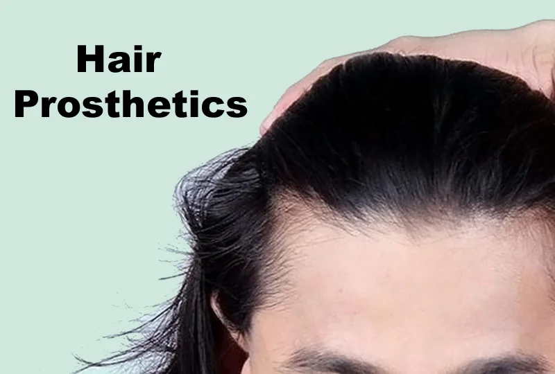 Hair Prosthetics