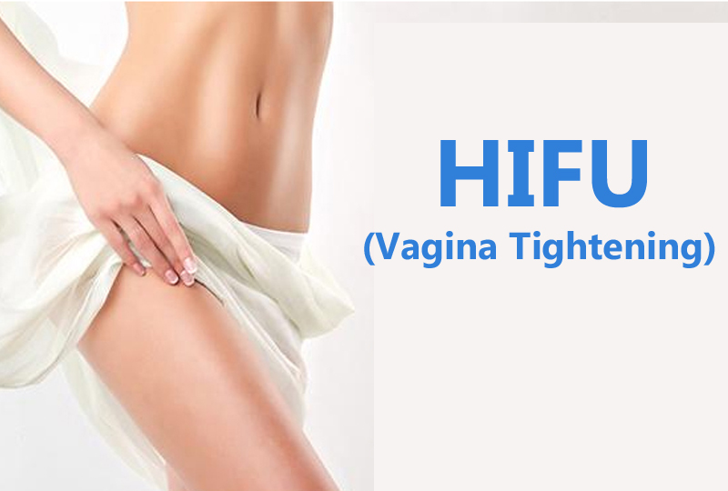 HIFU (Vaginal Tightening)