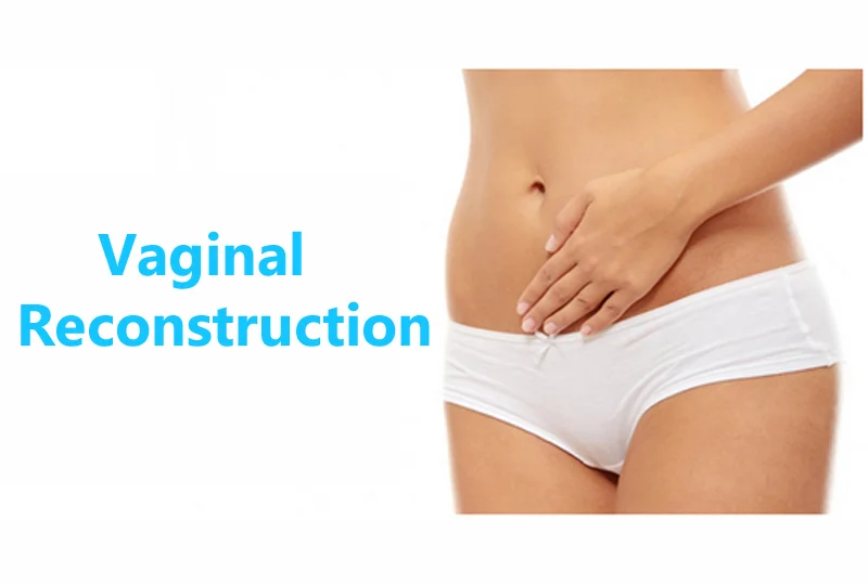 Vaginal Reconstruction